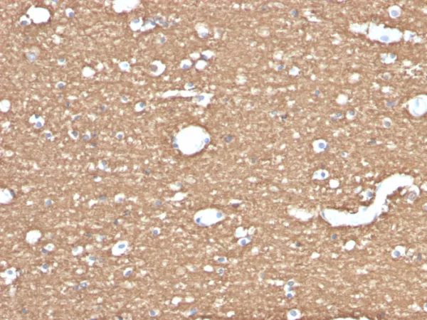 Formalin-fixed, paraffin-embedded human brain stained with Myelin Basic Protein Mouse Monoclonal Antibody (MBP/4275).