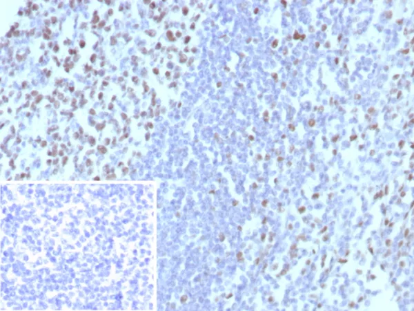 Formalin-fixed, paraffin-embedded human tonsil stained with MCM3 Recombinant Rabbit Monoclonal Antibody (MCM3/8972R). Inset: PBS instead of primary antibody, secondary only control.