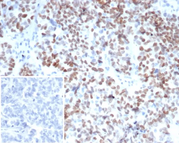 MEIS2 (Transcription Factor) Antibody