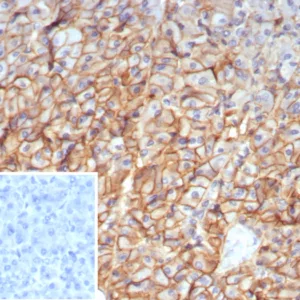 Formalin-fixed, paraffin-embedded human pancreas stained with  CD99 Mouse Monoclonal Antibody (MIC2/7861). Inset: PBS instead of primary antibody; secondary only negative control.