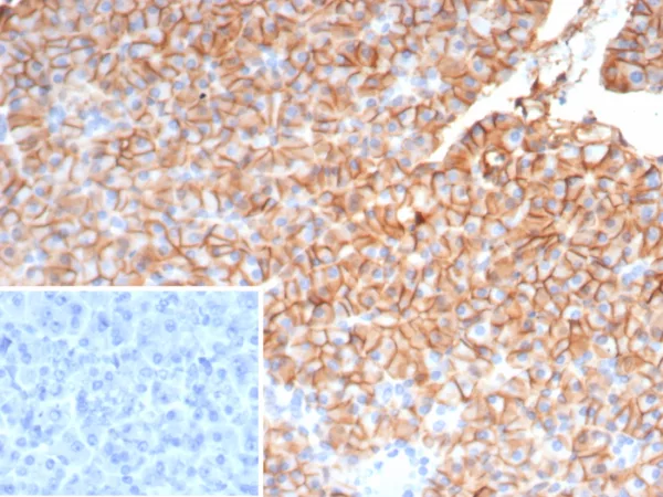 CD99 / MIC2 (Ewing s Sarcoma Marker) Antibody