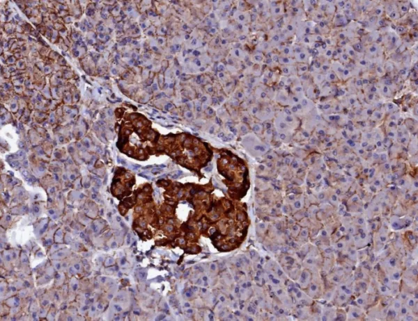 CD99 / MIC2 (Ewing s Sarcoma Marker) Antibody