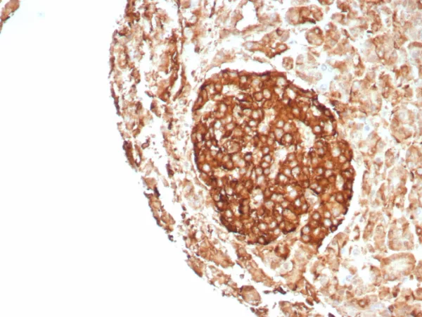 Recombinant CD99 / MIC2 (Ewing s Sarcoma Marker) Antibody