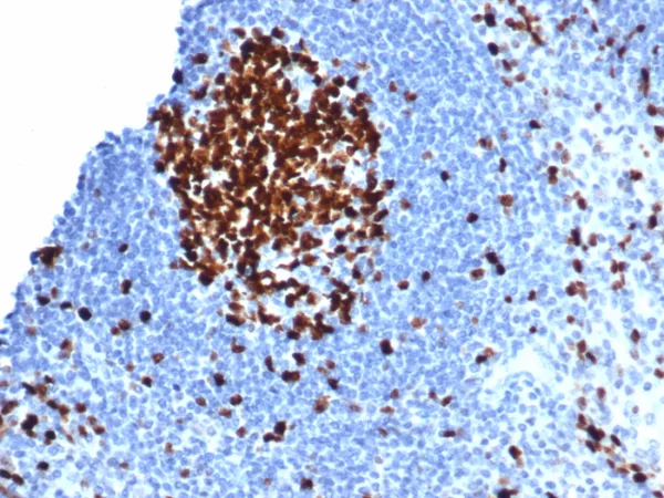 Formalin-fixed, paraffin-embedded human tonsil stained with Ki67-Monospecific Mouse Monoclonal Antibody (MKI67/6582). HIER: Tris/EDTA, pH9.0, 45min. 2°C: HRP-polymer, 30min. DAB, 5min.