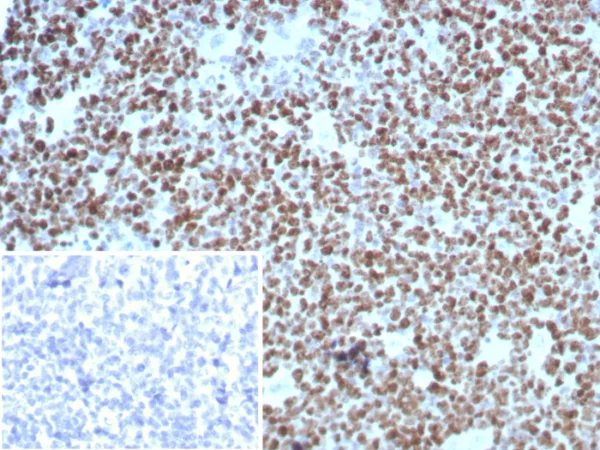 Recombinant Ki-67 (Proliferating Cell Marker) Antibody