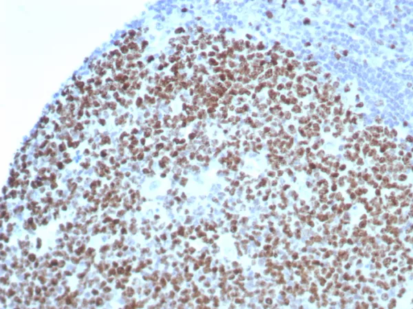 Recombinant Ki-67 (Proliferating Cell Marker) Antibody - Image 2