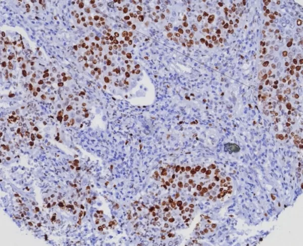 Recombinant Ki-67 (Proliferating Cell Marker) Antibody - Image 2