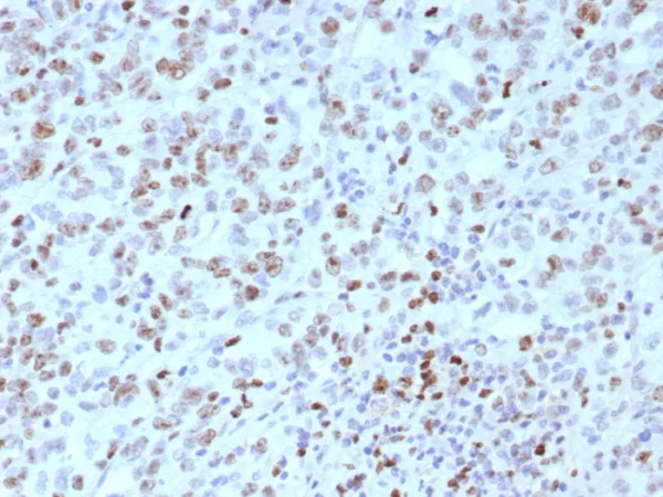 Recombinant MLH1 (MutL Homolog 1) (Center) / HNPCC Antibody