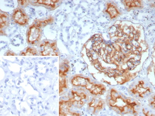 Recombinant CD10 (Membrane Metalloendopeptidase) Antibody - Image 2