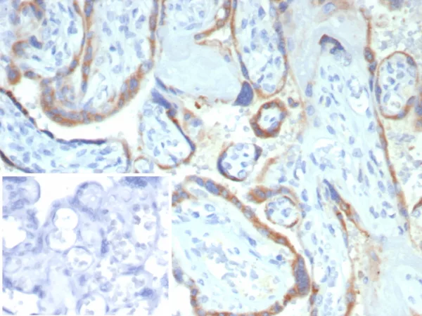 Formalin-fixed, paraffin-embedded human placenta stained with MMP2 Mouse Monoclonal Antibody (MMP2/4586). HIER: Tris/EDTA, pH9.0, 45min. 2: HRP-polymer, 30min. DAB, 5min.