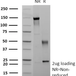 SDS-PAGE Analysis of Purified MUC1 Recombinant Mouse Monoclonal Antibody (r115D8). Confirmation of Purity and Integrity of Antibody.