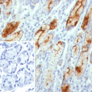 Formalin-fixed, paraffin-embedded human stomach stained with MUC1 Recombinant Rabbit Monoclonal Antibody (MUC1/8109R). Inset: PBS instead of primary antibody; secondary only negative control.