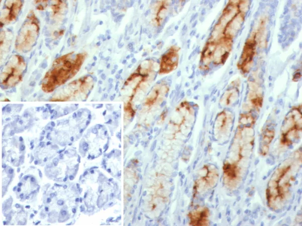 Formalin-fixed, paraffin-embedded human stomach stained with MUC1 Recombinant Rabbit Monoclonal Antibody (MUC1/8109R). Inset: PBS instead of primary antibody; secondary only negative control.