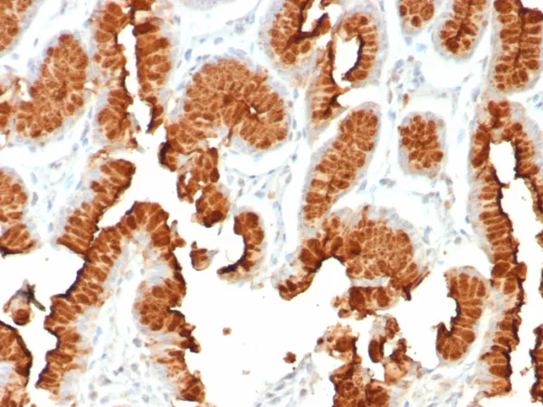 Formalin-fixed, paraffin-embedded human stomach stained with MUC5AC Recombinant Mouse Monoclonal (rMUC5AC/8052) at 2ug/ml. HIER: Tris/EDTA, pH9.0, 45min. 2°C: HRP-polymer, 30min. DAB, 5min.