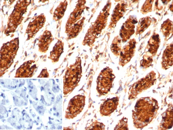 IHC analysis of formalin-fixed, paraffin-embedded human stomach. MUC5AC Recombinant Rabbit Monoclonal (MUC5AC/7798R). Inset: PBS instead of primary antibody; secondary only negative control.