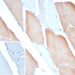 Formalin-fixed, paraffin-embedded human skeletal muscle stained with MYH7 Mouse Monoclonal Antibody (MYH7/9183). Inset: PBS instead of primary antibody; secondary only negative control.