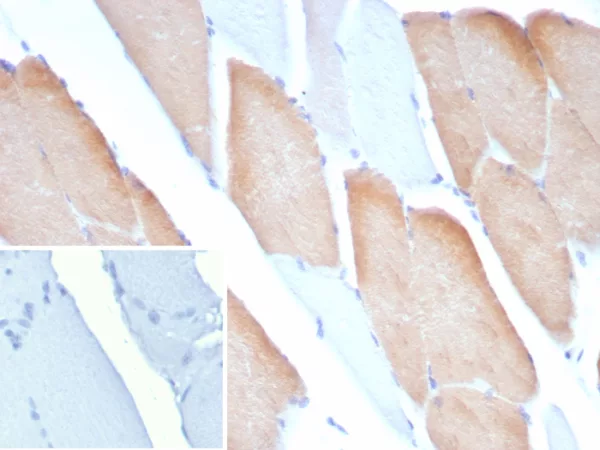 Formalin-fixed, paraffin-embedded human skeletal muscle stained with MYH7 Mouse Monoclonal Antibody (MYH7/9183). Inset: PBS instead of primary antibody; secondary only negative control.