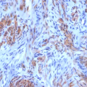 Formalin-fixed, paraffin-embedded human uterus stained with SM-MHC Mouse Monoclonal Antibody (SM-M10). HIER: Tris/EDTA, pH9.0, 45min. 2°C: HRP-polymer, 30min. DAB, 5min.