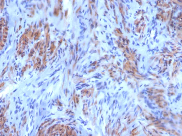 Formalin-fixed, paraffin-embedded human uterus stained with SM-MHC Mouse Monoclonal Antibody (SM-M10). HIER: Tris/EDTA, pH9.0, 45min. 2°C: HRP-polymer, 30min. DAB, 5min.