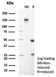 SDS-PAGE Analysis of Purified CD56 Rabbit Recombinant Monoclonal Antibody (NCAM1/8392R). Confirmation of Integrity and Purity of Antibody.