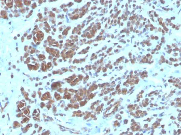 NME2 / nm23-H2 / NDPK-B (Suppressor of Metastasis) Antibody