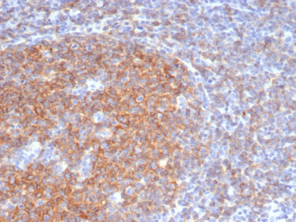 CD73 (Immuno-Oncology Target) Antibody - Image 2