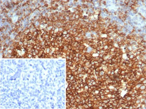 CD73 (Immuno-Oncology Target) Antibody - Image 3