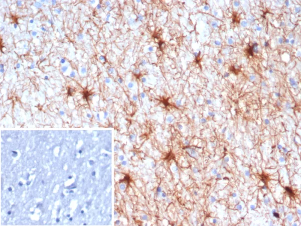 NTRK3 (Neurotrophic Receptor Tyrosine Kinase 3) Antibody - Image 3