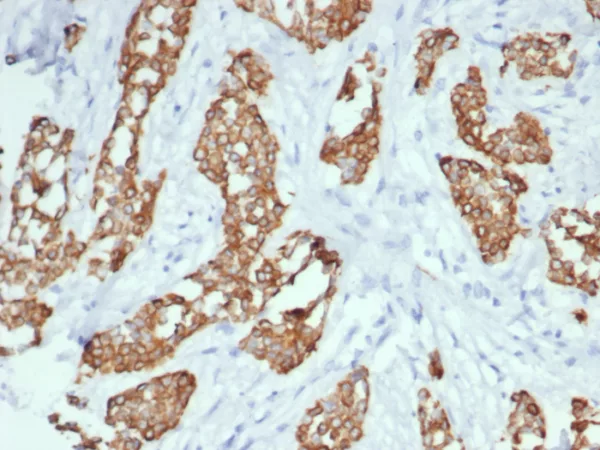 NTRK3 (Neurotrophic Receptor Tyrosine Kinase 3) Antibody - Image 4