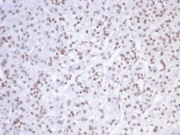 SMARCAL1 Antibody - Image 2