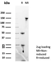 SDS-PAGE Analysis of Purified Langerin Mouse Monoclonal Antibody (LGRN/7429). Confirmation of Purity and Integrity of Antibody.