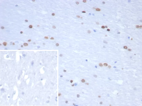 Formalin-fixed, paraffin-embedded human brain stained with NEUROG3 Mouse Monoclonal Antibody (NGN3/1809) Inset: PBS instead of primary antibody; secondary only negative control.