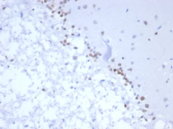 Formalin-fixed, paraffin-embedded human brain stained with NEUROG3 Mouse Monoclonal Antibody (NGN3/1809) HIER: Tris/EDTA, pH9.0, 45min. 2°C: HRP-polymer, 30min. DAB, 5min.