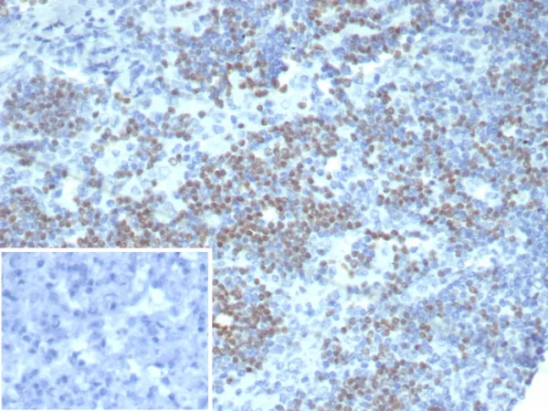 Formalin-fixed, paraffin-embedded human lymph node stained with PAX3 Mouse Monoclonal Antibody (PAX3/8426). HIER: Tris/EDTA, pH9.0, 45min. 2°C: HRP-polymer, 30min. DAB, 5min.