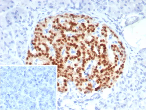 Formalin-fixed, paraffin-embedded human pancreas stained with PAX6 Mouse Monoclonal Antibody (PAX6/7707). Inset: PBS instead of primary antibody; secondary only negative control.