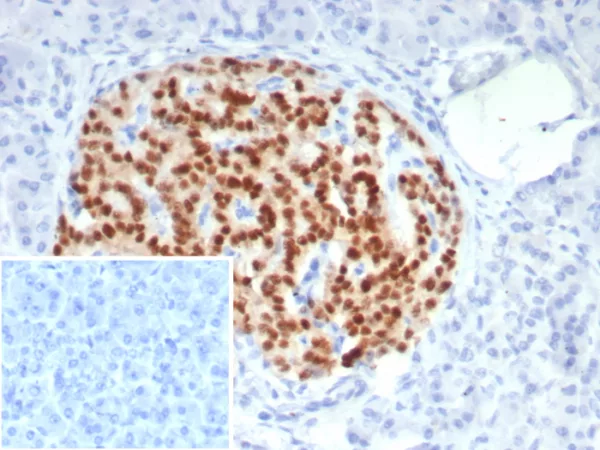 Formalin-fixed, paraffin-embedded human pancreas stained with PAX6 Mouse Monoclonal Antibody (PAX6/7708). Inset: PBS instead of primary antibody; secondary only negative control.