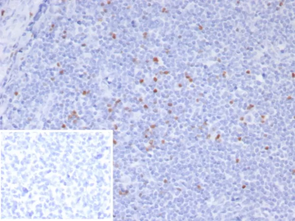 Recombinant FOXP3 (Forkhead Box Protein P3) / Scurfin Antibody - Image 2