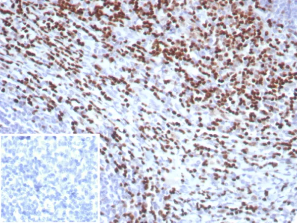 Recombinant LEF1 / TCF1 alpha (Transcription Factor) Antibody