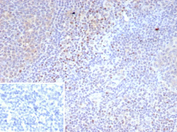 Formalin-fixed, paraffin-embedded analysis of human tonsil.  Strong nuclear staining of non-germinal center cells using LEF1/9403R. Inset: PBS instead of primary antibody; secondary only negative control.