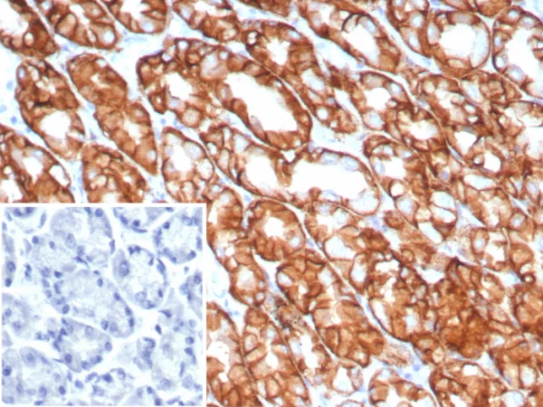 Formalin-fixed, paraffin-embedded human stomach stained with Claudin18.2 Recombinant Rabbit Monoclonal Antibody (CLDN18.2/8141R). Inset: PBS instead of primary antibody; secondary only negative control.