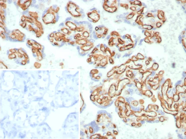 Formalin-fixed, paraffin-embedded human placenta stained with CD31 Rabbit Recombinant Monoclonal Antibody (C31/8359R). Inset: PBS instead of primary antibody; secondary only negative control.