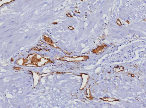 Formalin-fixed, paraffin-embedded human uterus stained with CD31 Rabbit Recombinant Monoclonal Antibody (C31/8377R). HIER: Tris/EDTA, pH9.0, 45min. 2: HRP-polymer, 30min. DAB, 5min.