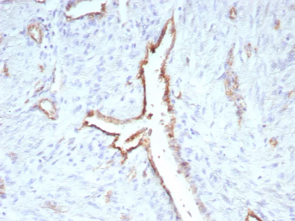 Formalin-fixed, paraffin-embedded human uterus stained with CD31 Rabbit Recombinant Monoclonal Antibody (C31/9224R). HIER: Tris/EDTA, pH9.0, 45min. 2°C: HRP-polymer, 30min. DAB, 5min.