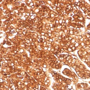 Formalin-fixed, paraffin-embedded human adrenal gland stained with MDR1 Recombinant Rabbit Monoclonal Antibody (MDR1/8986R). HIER: Tris/EDTA, pH9.0, 45min. 2°C: HRP-polymer, 30min. DAB, 5min.