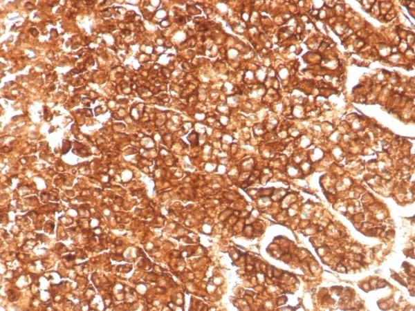 Formalin-fixed, paraffin-embedded human adrenal gland stained with MDR1 Recombinant Rabbit Monoclonal Antibody (MDR1/8986R). HIER: Tris/EDTA, pH9.0, 45min. 2°C: HRP-polymer, 30min. DAB, 5min.