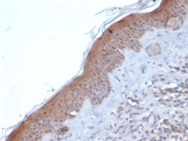 Formalin-fixed, paraffin-embedded human skin stained with Maspin Mouse Monoclonal Antibody (SERPINB5/4971). HIER: Tris/EDTA, pH9.0, 45min. 2°C: HRP-polymer, 30min. DAB, 5min.