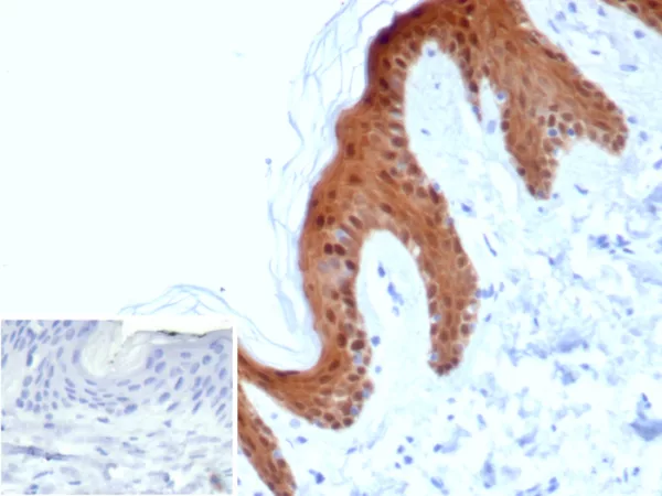 Formalin-fixed, paraffin-embedded human skin stained with SERPINB5 / Maspin Mouse Monoclonal Antibody (SERPINB5/4978). 	Inset: PBS instead of primary antibody; secondary only negative control.