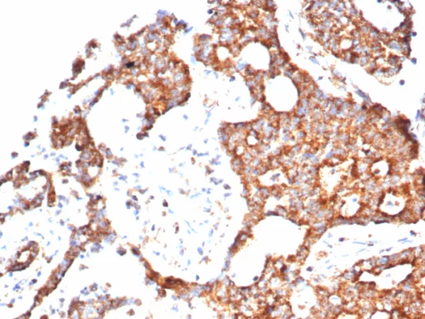 PTEN (Tumor Suppressor Oncoprotein) Antibody - Image 2