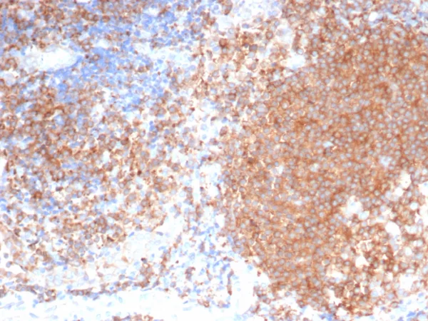 Formalin-fixed, paraffin-embedded human tonsil stained with PLK1 Mouse Monoclonal Antibody (PLK1/7122). HIER: Tris/EDTA, pH9.0, 45min. 2°C: HRP-polymer, 30min. DAB, 5min.