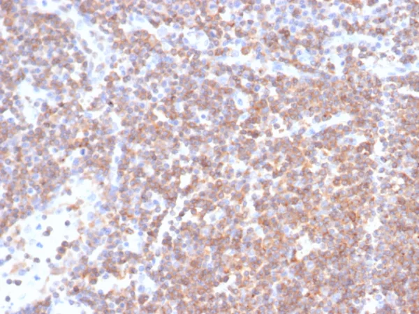 Formalin-fixed, paraffin-embedded human lymph node stained with PLK1 Mouse Monoclonal Antibody (PLK1/7122). HIER: Tris/EDTA, pH9.0, 45min. 2°C: HRP-polymer, 30min. DAB, 5min.